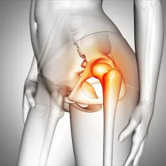 Model anatomiczny ukazujący ból kręgosłupa promieniujący do bioder i brzucha. Czerwone podświetlenie zaznacza obszar bólu.