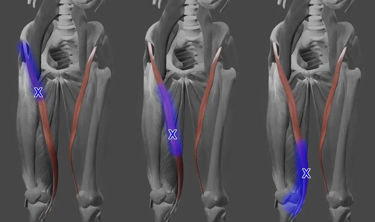 Anatomia uda: mięsień krawiecki, zaznaczony na niebiesko, biegnie od biodra do wewnętrznej strony kolana.
