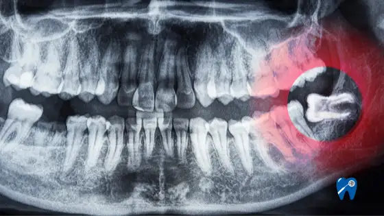 Ząb obrotnika C2 - kiedy ból szyi wymaga diagnostyki?